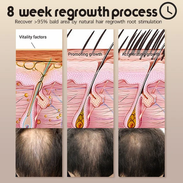 Suupillid ™ Cov plaub hau Regrowth African Chebe Hair Care Essentials Set