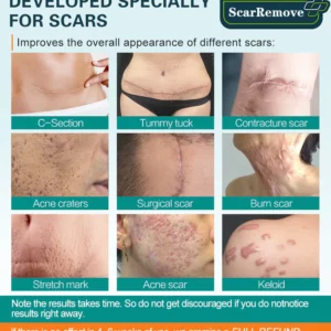 Suupillid™ Advanced Scar Spray