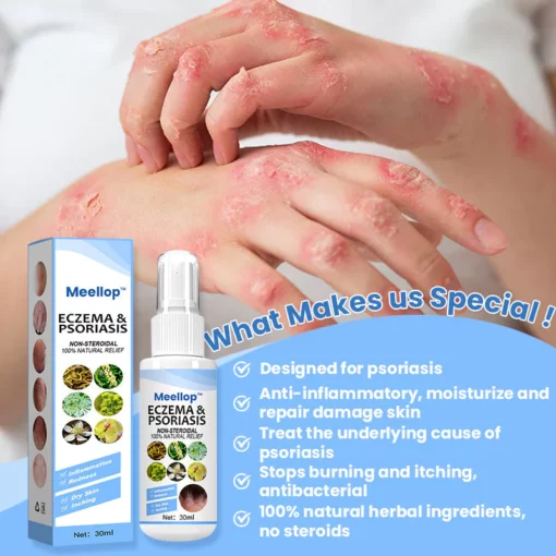 Suupillid™ Herbal Psoriasis Relief Spray