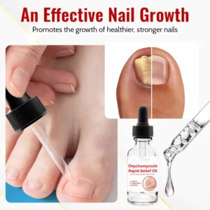 Suupillid™ Japanese NailRenew Onychomycosis Rapid Relief Oil