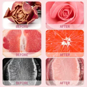 Suupillid™ Soothe&Slim Instant Anti-Itch Detox Slimming Products