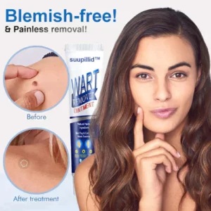Suupillid™ Wart Removal Ointment