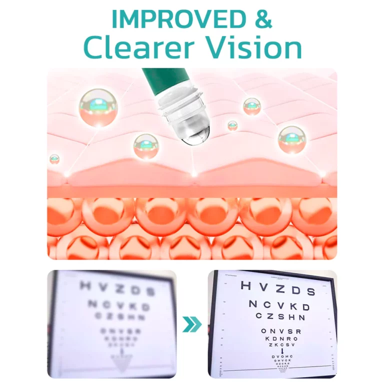 TLOPA™ OphthlaMed valjak za poboljšanje vida