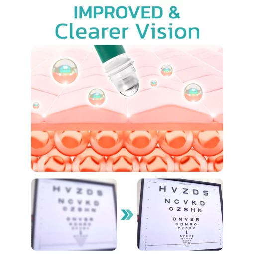 TLOPA™ OphthlaMed Vision Enhance Roller