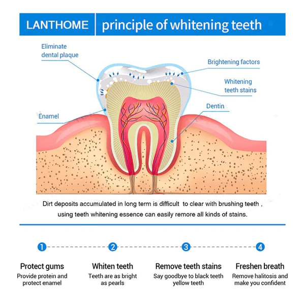 दाँत का सफेद होना