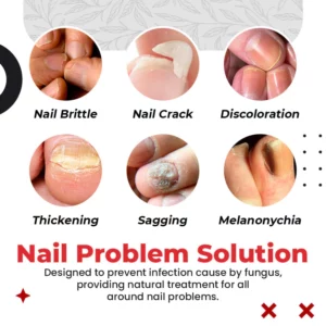 Toenail Pro™ Anti-Fungus Relief Oil