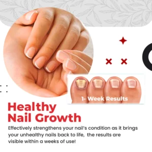 Toenail Pro™ Anti-Fungus Relief Oil