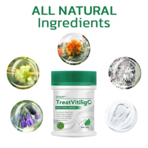 TreatVitiligo Soothing Cream