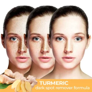 Turmeric Dark Spot Corrector Serum
