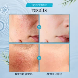 VIBRANT GLAMOUR Hyaluronic Acid Face Serum