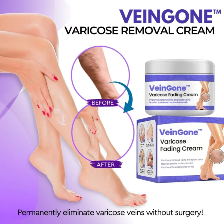 VeinGone™ भेरिकोज फेडिंग क्रीम