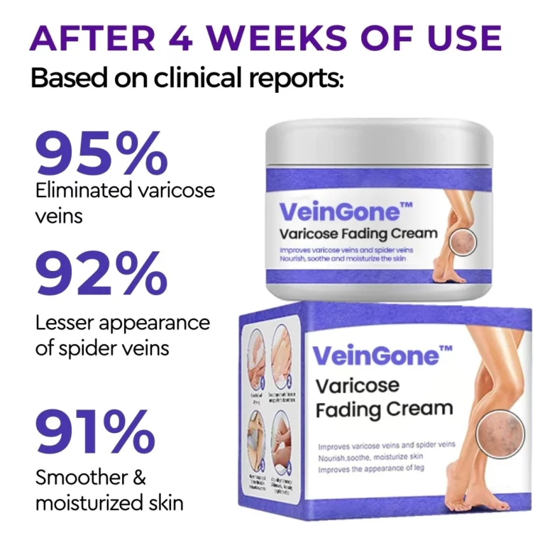 Setlolo sa VeinGone™ Varicose Fading Cream