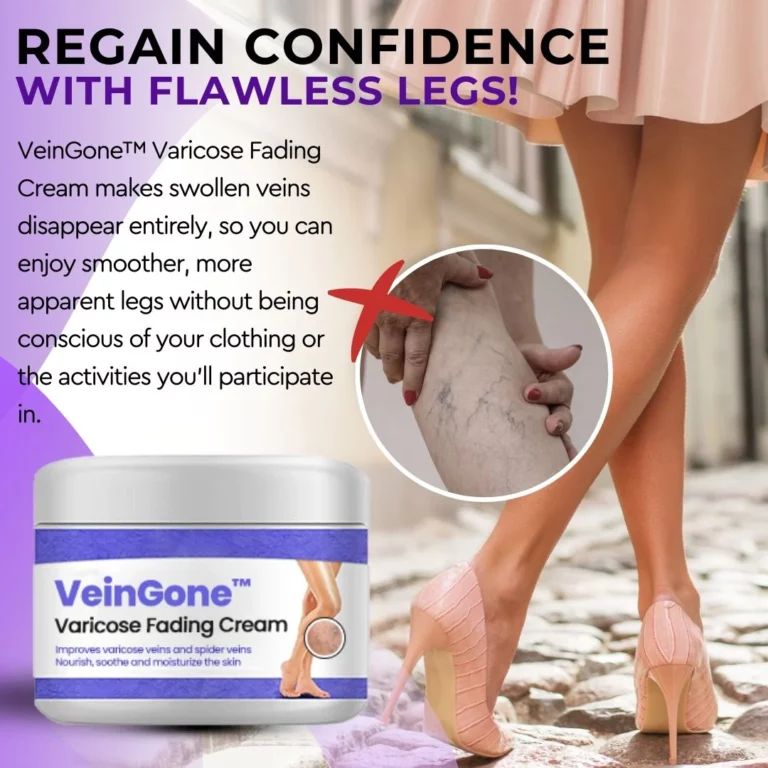 VeinGone™ krema za bledenje krčnih žil