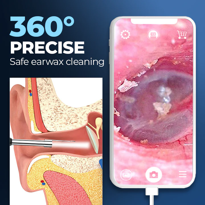 ViewScan™ Viditelný otoskop pro čištění ušního mazu