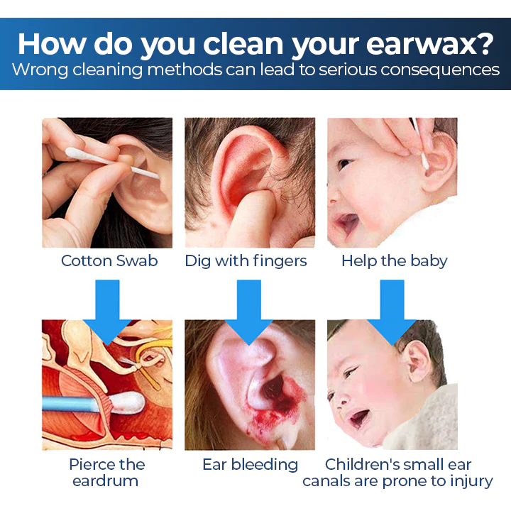 ViewScan™ Visible Earwax Cleaning Otoskop
