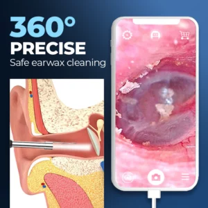 ViewScan™ Visible Earwax Cleaning Otoscope