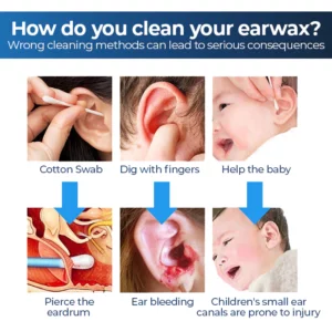 ViewScan™ Visible Earwax Cleaning Otoscope