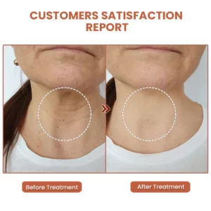 Vita Collagen Bounce Wrinkle Balm
