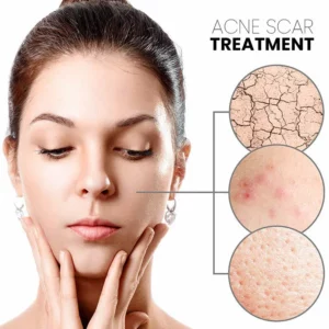 Vita Collagen Bounce Wrinkle Balm