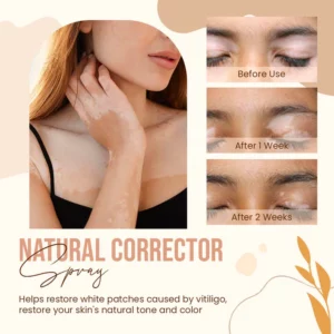 VitaDerm™ Re-pigment Spray