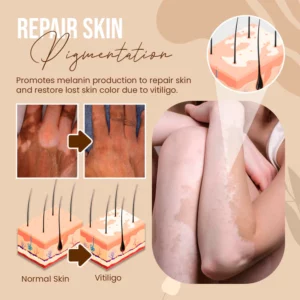 VitaDerm™ Re-pigment Spray