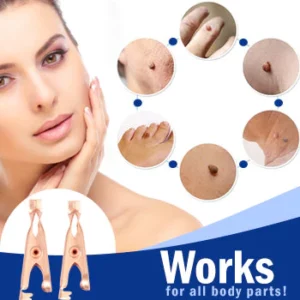 Wart Removal Sterile Clip
