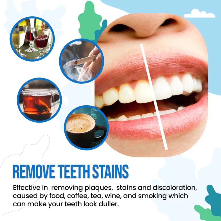 WhiteOut™ инстант белење на заби