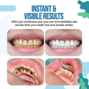 WhiteOut™ Instant Teeth Whitening Paint
