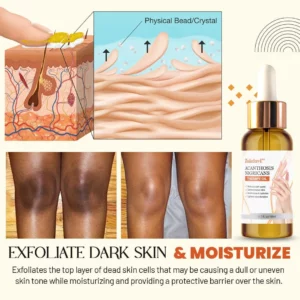 Zakdavi™ Acanthosis Nigricans Treatment Oil