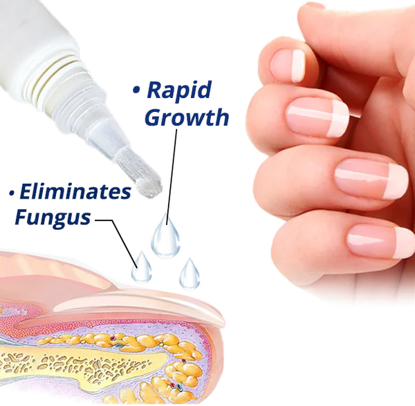 flysmus™ 7 ka Adlaw nga Nail Recovery Rapid Growth Essence Pen