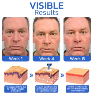 flysmus™ YoungEyes Awaken Peptid Lifting Augengel