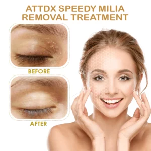 Alternative view of Speedy Milia Removal Treatment