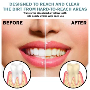 Alternative view of ATTDX TeethWhitening Cleaning Essence Pen