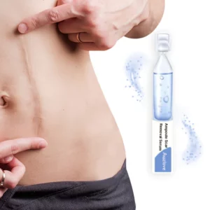 Alternative view of Awzlove Ampoule Scar Removal Serum