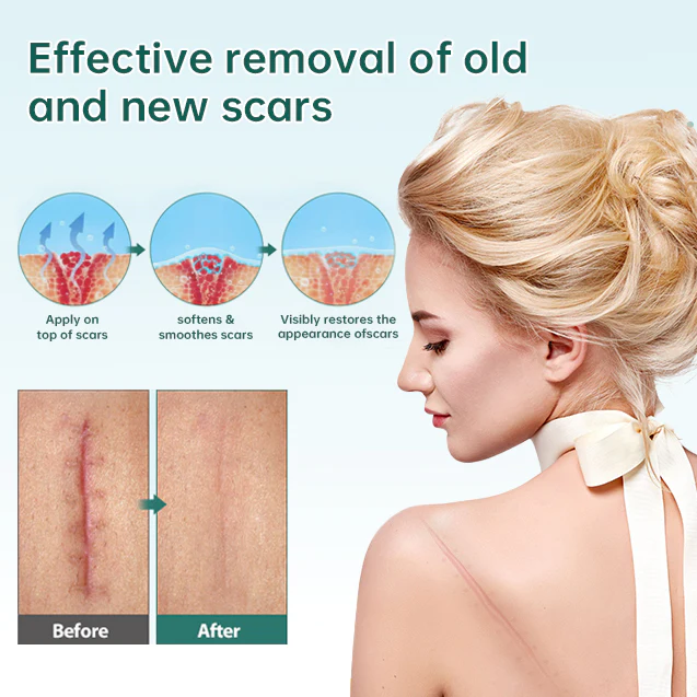 Awzlove Ampoule Scar Removal Serum - Image 4