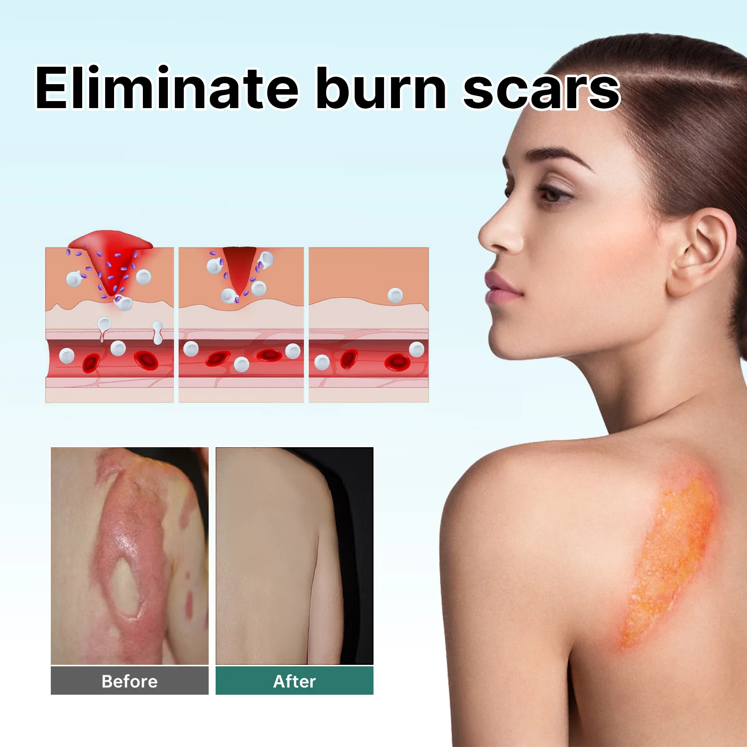 Awzlove Ampoule Scar Removal Serum - Image 5