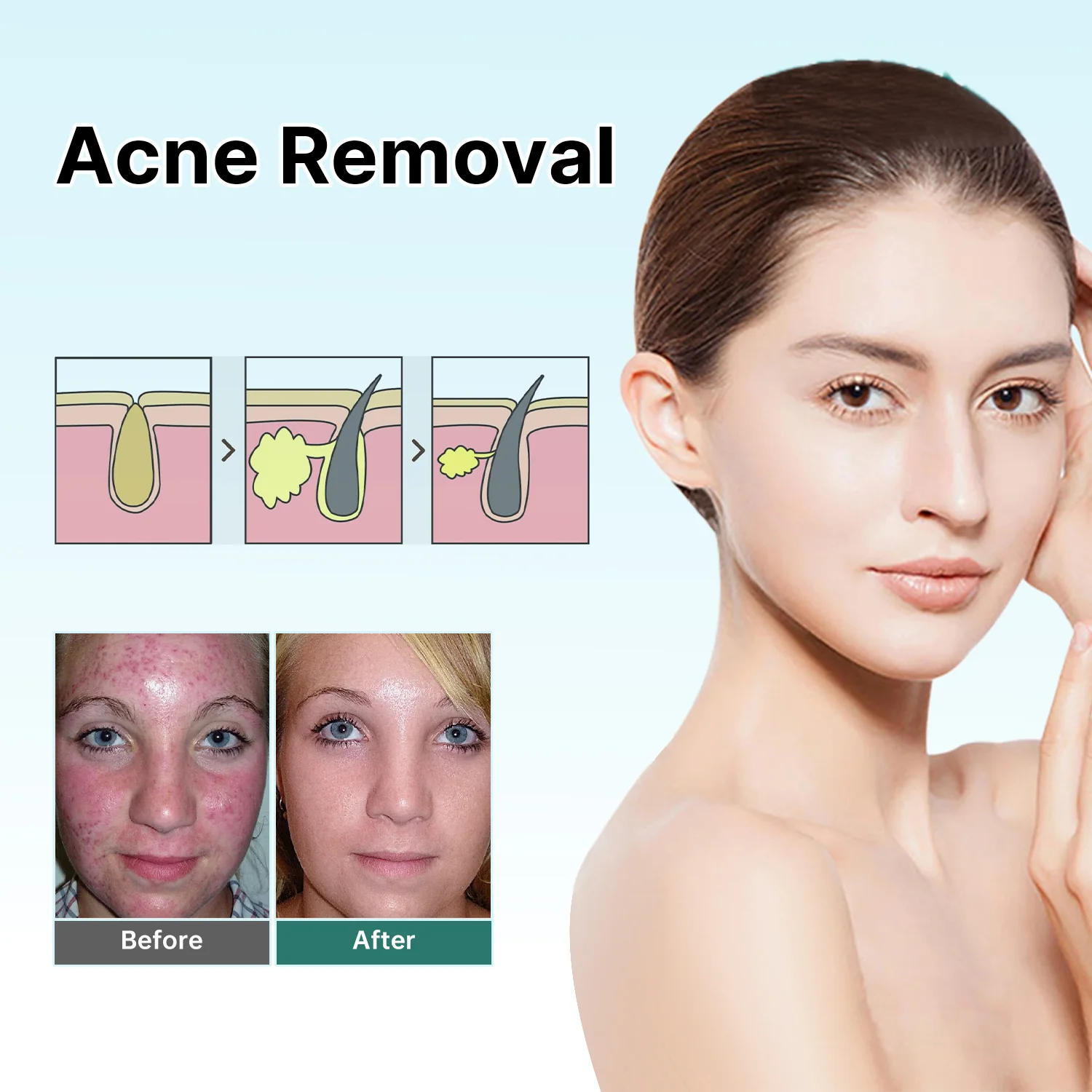 Awzlove Ampoule Scar Removal Serum - Image 6