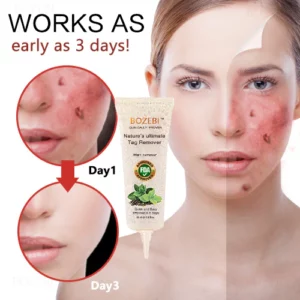 Alternative view of BOZEBI Advanced Tags & Moles Remover