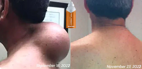 Body Therapy™ Bee Venom Joint & Bone Therapy Spray - Image 7