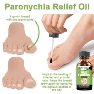Alternative view of CC FootCure Removal Paronychia Gel