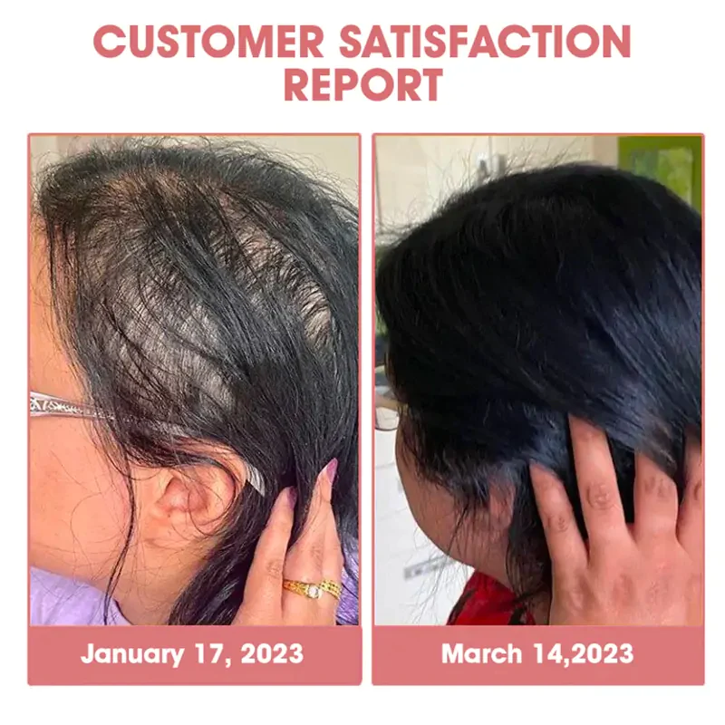 CPO Follicle Nourishing HairGrowth Serum - Image 5