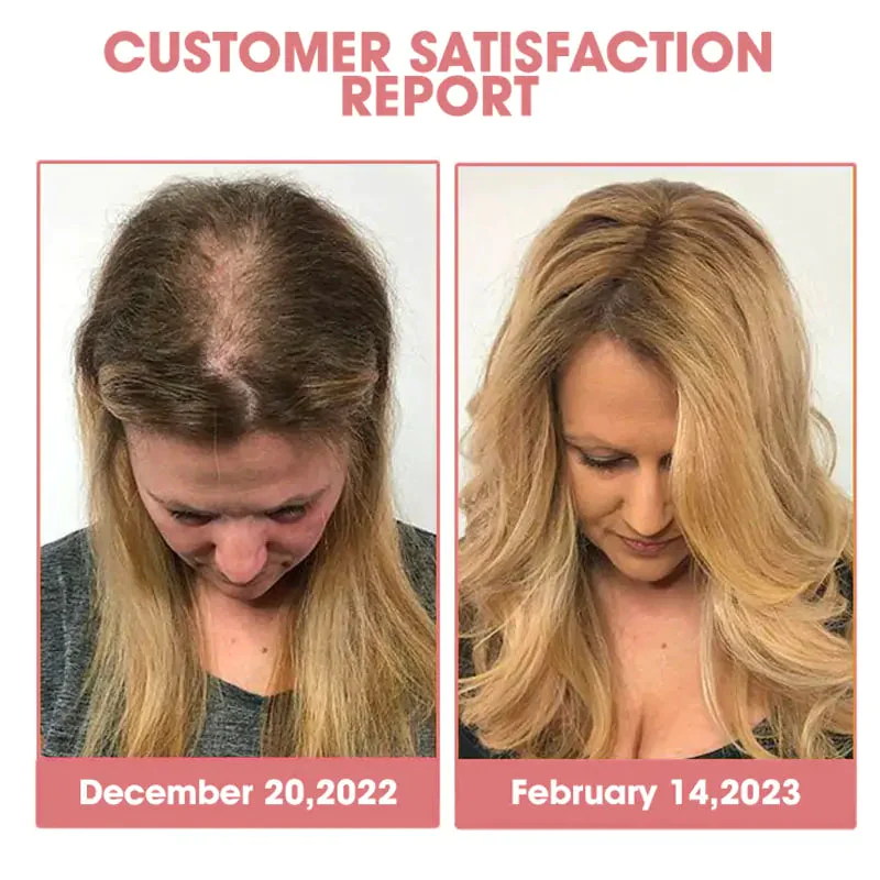 CPO Follicle Nourishing HairGrowth Serum - Image 6
