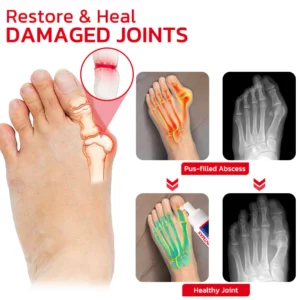 Alternative view of GFOUK™ JointMax Therapy and Inflammation Relief Gel