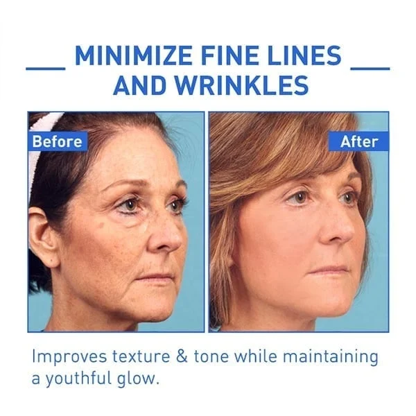 Oveallgo Youthfully Botox Face Serum - Image 3