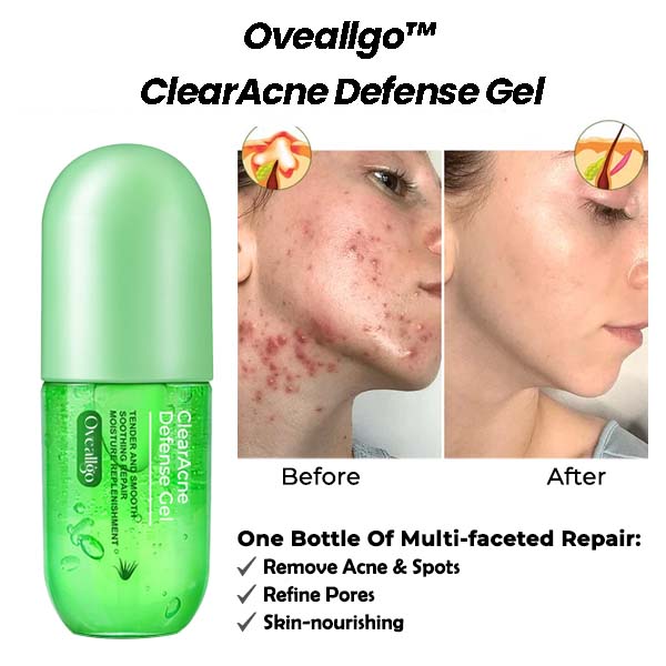 Oveallgo ClearAcne Defense Gel - Image 3