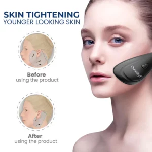 Alternative view of Oveallgo JawFit Pro Face Sculptor
