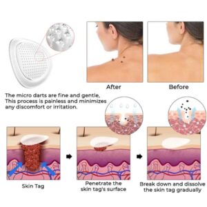 Alternative view of Oveallgo Pro MicroDarts TAG'Gone Patch