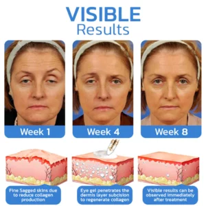 Alternative view of SKTQL NMN Syringe Eye Cream