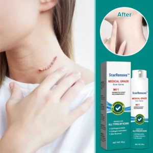Alternative view of ScarRemove Scar and Stretch Mark Refining Spray