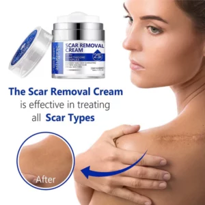 Alternative view of SkinRevive™ Advanced scar cream